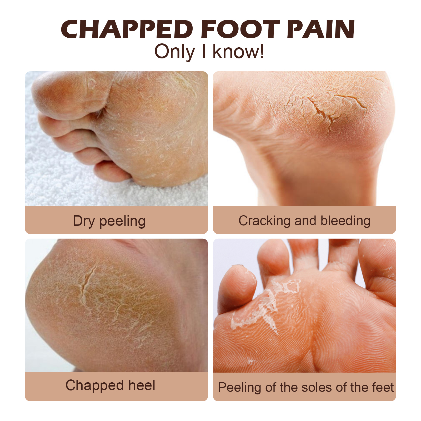 EELHOE  Horse Oil Foot Cream, Hydrating And Moisturizing Foot Care Cream To Repair Dry, Cracked And Peeling Foot Skin